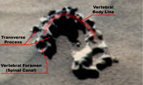 Spine Anatomy Spine Anatomy